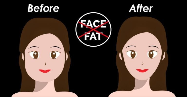 How to Lose Face Fat: 10 Effective Tips (with Pictures)